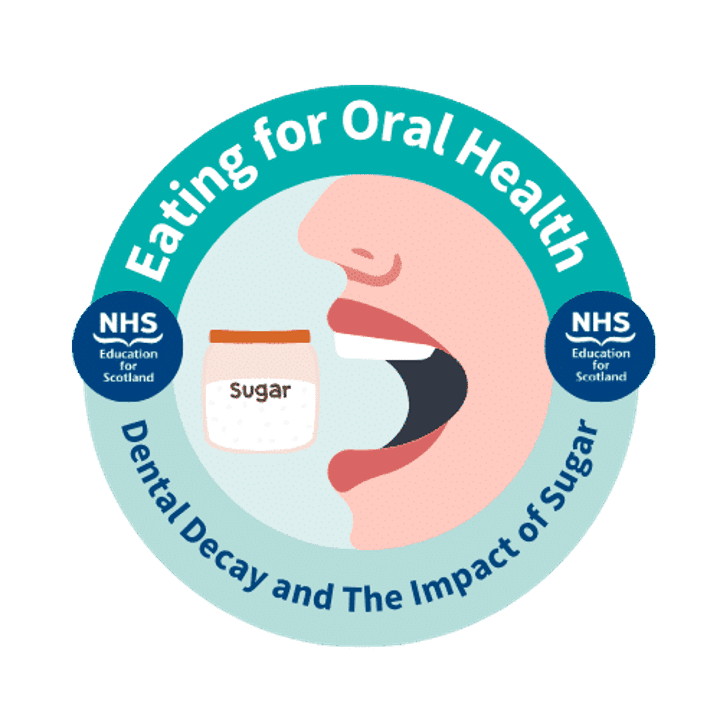 Early Childhood Decay and Impact of Sugar image